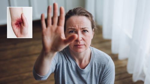 Symptoms and coping with Ehlers-Danlos syndrome hypermobility type