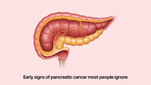 Early signs of pancreatic cancer most people ignore