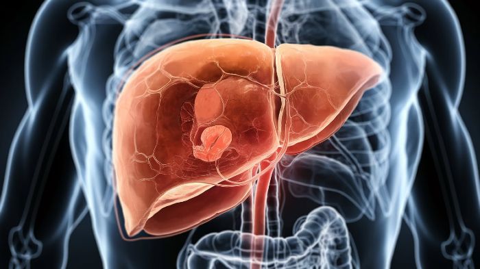 Liver cirrhosis complications in alcohol use disorder