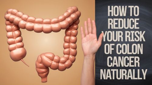 How to reduce your risk of colon cancer naturally