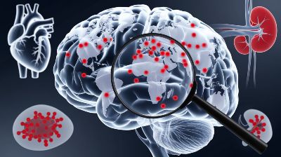 Understanding the Hidden Complications of Chronic Diseases