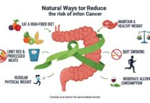 How to reduce your risk of colon cancer naturally How to reduce your risk of colon cancer naturally